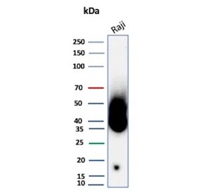 CD38 Antibody human Raji lysate WB. Western blot analysis of CD38 expression in human Raji cell lysate using CD38 antibody. Lane 1: human Raji cell lysate. A band is detected at approximately 40-45 kDa, consistent with the predicted molecular weight of CD38, with higher apparent molecular weight reflecting glycosylation of this NAD-metabolizing cell surface protein. The detection profile supports its role in studies of immunometabolism and NAD-dependent signaling pathways in immune cells.