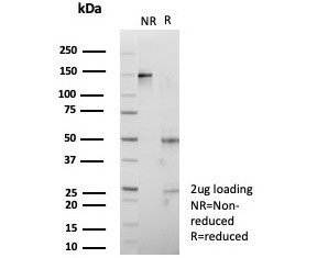 SDS-PAGE analysis of purified, BSA-free IGF2BP2 antibody (clone PCRP-IGF2BP2-1F9) as confirmation of integrity and purity.