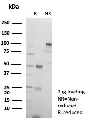 SDS-PAGE analysis of purified, BSA-free p63 Antibody / Prostate Basal Cell Marker Antibody (clone rP40/8765) as confirmation of integrity and purity.