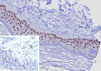 TP63 Antibody Skin IHC. Immunohistochemistry analysis of Tumor protein 63 (TP63) in FFPE human skin tissue using a TP63 antibody as an epithelial stem cell marker (clone TP63/7807R) demonstrates strong HRP-DAB brown nuclear staining in basal keratinocytes along the epidermal basal layer. The staining is confined to progenitor cell populations at the dermal-epidermal junction, while suprabasal differentiated keratinocytes show reduced or absent signal, consistent with the role of TP63 in maintaining epithelial stem and progenitor cell compartments. The nuclear localization clearly outlines the basal layer and highlights epidermal organization and stratification. Inset: PBS was used in place of the primary antibody as a negative control, showing no brown signal. Heat-induced epitope retrieval was performed by boiling tissue sections in pH 9 10mM Tris with 1mM EDTA for 20 minutes followed by cooling prior to antibody incubation.