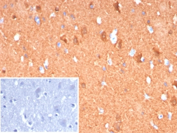 PGP9.5 Antibody / High Abundance Neuronal Marker Antibody. Immunohistochemistry analysis of PGP9.5 / UCHL1 in FFPE human cerebellum tissue. IHC staining of FFPE human cerebellum using PGP9.5 Antibody / High Abundance Neuronal Marker Antibody demonstrates strong HRP-DAB brown cytoplasmic signal in neuronal cells, reflecting the high endogenous abundance of UCHL1 in neural tissue. The robust staining intensity enables clear identification of neuronal cell bodies and processes with high contrast relative to surrounding tissue, supporting reliable visualization even under standard staining conditions. Clone UCHL1/8152 produces consistent and easily interpretable signal, while the PBS control shows no staining, confirming specificity and low background.