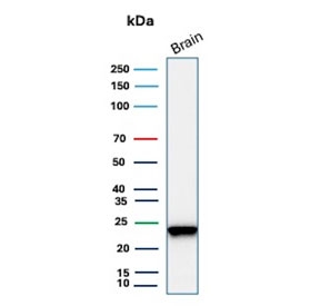 PGP9.5 Antibody / High Abundance Neuronal Marker Antibody for WB. Western blot analysis of PGP9.5 / UCHL1 in human brain tissue lysate. Lane 1: human brain lysate. A band is detected at approximately 25 kDa, consistent with the predicted molecular weight of Protein gene product 9.5 / UCHL1. The strong band intensity observed reflects the high endogenous abundance of this protein in neuronal tissue, supporting robust and reliable detection in western blot analysis.