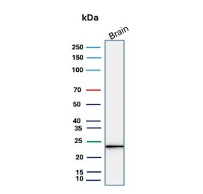 UCHL1 Antibody for WB. Western blot analysis in human brain lysate. Human brain tissue lysate stained with UCHL1 Antibody for WB, also known as Deubiquitinase Western Blot Antibody and Ubiquitin C-terminal hydrolase L1 antibody, shows a clear band at approximately 25 kDa, consistent with the predicted molecular weight of UCHL1 / PGP9.5. The sharp band profile supports its use for detecting this deubiquitinating enzyme in studies of ubiquitin-mediated protein turnover and proteasome pathway regulation.