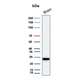 UCHL1 Antibody for WB. Western blot analysis in human brain lysate. Human brain tissue lysate stained with UCHL1 Antibody for WB, also known as Cancer Cell Western Blot Antibody and Ubiquitin C-terminal hydrolase L1 antibody, shows a distinct band at approximately 25 kDa, consistent with the predicted molecular weight of UCHL1 / PGP9.5. The clear band supports its use for detecting UCHL1 in tumor-related western blot workflows, including comparative analysis of cancer cell lysates and evaluation of tumor-associated protein expression.