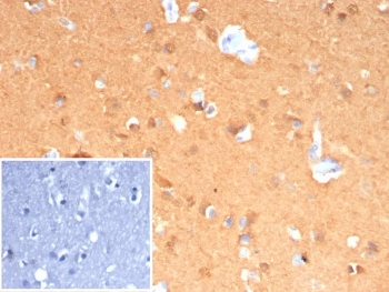 IHC staining of FFPE human cerebellum tissue with UCHL1 antibody (clone rUCHL1/8133). Inset: PBS used in place of primary Ab (secondary Ab negative control). HIER: boil tissue sections in pH 9 10mM Tris with 1mM EDTA for 20 min and allow to cool before testing.