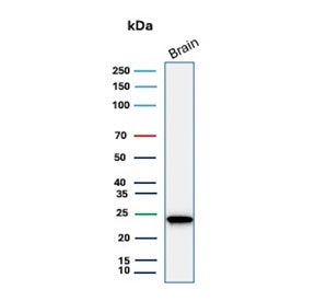 PGP9.5 Antibody for WB. Western blot analysis in human brain lysate. Human brain tissue lysate stained with PGP9.5 Antibody for WB, also known as Neuronal Marker Western Blot Antibody and Ubiquitin C-terminal hydrolase L1 antibody, shows a strong band at approximately 25 kDa, consistent with the predicted molecular weight of PGP9.5 / UCHL1. The intense signal in brain tissue aligns with the well-established neuronal enrichment of this protein, supporting its use as a reliable marker for neuronal protein expression in western blot applications.