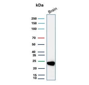 PGP9.5 Antibody for WB. Western blot analysis in human brain lysate. Human brain tissue lysate stained with PGP9.5 Antibody for WB, also known as 25 kDa Protein Western Blot Antibody and Ubiquitin C-terminal hydrolase L1 antibody, shows a sharp, well-defined band at approximately 25 kDa, consistent with the predicted molecular weight of PGP9.5 / UCHL1. The clean, single-band resolution highlights its suitability for low molecular weight protein detection and precise size-based analysis in western blot workflows.
