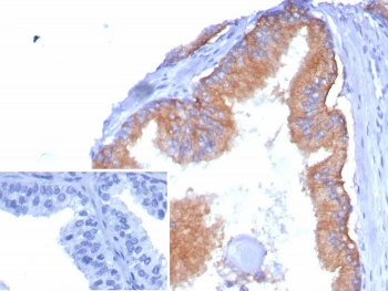 CD38 Antibody human tonsil tissue IHC. Immunohistochemistry analysis of CD38 expression in FFPE human tonsil tissue using CD38 antibody clone rCD38/8334. Strong membranous and cytoplasmic HRP-DAB brown staining highlights plasma cells and activated lymphocytes within interfollicular regions and around germinal centers, consistent with a differentiation-associated expression pattern across immune cell populations. The staining demonstrates variable intensity among positive cells, reflecting heterogeneity in maturation state, with clear contrast against predominantly negative background lymphocytes. Inset: PBS was used in place of the primary antibody as a secondary antibody negative control. HIER was performed by boiling tissue sections in pH 9 10 mM Tris with 1 mM EDTA for 20 minutes followed by cooling prior to antibody incubation.