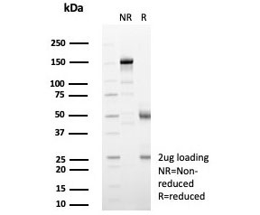 SDS-PAGE analysis of purified, BSA-free Interleukin-2 antibody (clone IL2/4985) as confirmation of integrity and purity.