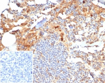 MIG9 Antibody / Migration Inducing Gene 9 Antibody (clone S100P/7374) in human tonsil tissue. Immunohistochemistry staining of FFPE human tonsil demonstrates cytoplasmic staining in scattered epithelial and inflammatory cells consistent with expression of S100 calcium binding protein P / S100P, also known as migration inducing gene 9 (MIG9). Brown chromogenic signal highlights MIG9-positive cells within the tonsillar tissue while surrounding lymphoid populations show comparatively weaker staining. The inset shows PBS used in place of primary antibody as a secondary-only negative control. Heat-induced epitope retrieval was performed by boiling tissue sections in pH 9 Tris buffer with 1 mM EDTA for 20 min before staining.