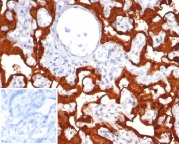 Migration Inducing Gene 9 Antibody / S100P Antibody (clone S100P/7375) in human placental tissue. Immunohistochemistry staining of FFPE human placenta demonstrates strong cytoplasmic staining in trophoblastic epithelial cells consistent with the known epithelial expression pattern of S100 calcium binding protein P / S100P, also referred to as migration inducing gene 9 (MIG-9). Brown chromogenic signal highlights S100P-positive trophoblast layers while surrounding stromal elements show comparatively weaker staining. The inset shows PBS used in place of primary antibody as a secondary-only negative control. Heat-induced epitope retrieval was performed by boiling tissue sections in pH 9 Tris buffer with 1 mM EDTA for 20 min before staining.