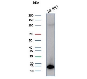 S100P Antibody for WB / MIG9 Antibody for Western Blotting (clone S100P/7373). Western blot analysis of human SK-BR-3 cell lysate demonstrates detection of S100 Calcium Binding Protein P / MIG9 using S100P Antibody for WB. A band is detected at approximately 10 kDa, consistent with the predicted molecular weight of S100P. Lane 1: human SK-BR-3 whole cell lysate.