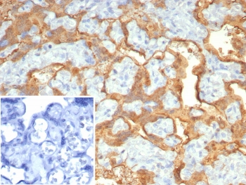 IHC staining of FFPE human placenta with S100P antibody (clone S100P/7373). Inset: PBS used in place of primary Ab (secondary Ab negative control). HIER: boil tissue sections in pH 9 10mM Tris with 1mM EDTA for 20 min and allow to cool before testing.