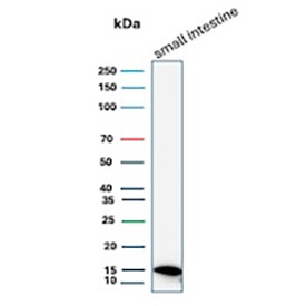 I-FABP Antibody Small Intestine WB. Western blot analysis of human small intestine tissue lysate using I-FABP antibody clone FABP2/7670. A band is detected at approximately 15 kDa, consistent with the predicted molecular weight of Intestinal fatty acid-binding protein / FABP2, a cytoplasmic lipid transport protein enriched in intestinal epithelial cells.
