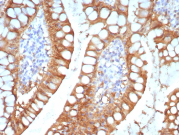 I-FABP Antibody Small Intestine IHC. Immunohistochemistry staining of FFPE human small intestine tissue with I-FABP antibody (clone FABP2/7670). HIER: boil tissue sections in pH 9 10mM Tris with 1mM EDTA for 20 min and allow to cool before testing.