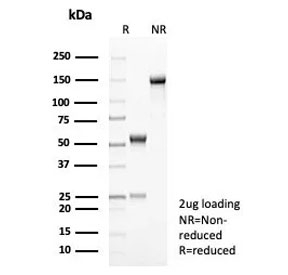 SDS-PAGE analysis of purified, BSA-free Interleukin-2 antibody (clone IL2/8712) as confirmation of integrity and purity.