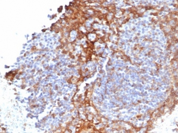 STING Antibody Clone STING1/7436 immunohistochemistry analysis of human tissue. IHC staining of formalin-fixed, paraffin-embedded human tonsil using STING Antibody Clone STING1/7436 demonstrates HRP-DAB brown cytoplasmic staining in lymphoid immune cells within tonsillar tissue, consistent with expression of Stimulator of interferon genes protein / STING1 (TMEM173) in antigen-presenting immune cell populations. Heat-induced epitope retrieval was performed by boiling tissue sections in pH 9 10 mM Tris with 1 mM EDTA for 20 min followed by cooling prior to antibody incubation.
