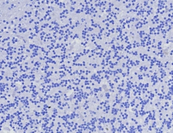 Negative control: IHC testing of FFPE human brain tissue with AMACR antibody (clone AMACR/8350R) at 2ug/ml. HIER: boil tissue sections in pH 9 10mM Tris with 1mM EDTA for 20 min and allow to cool before testing.