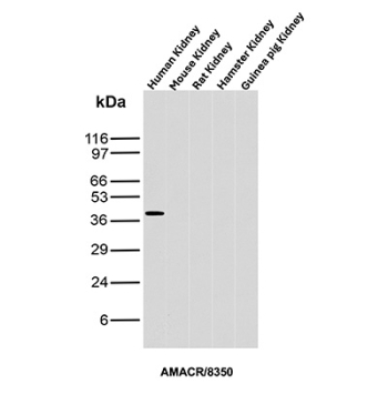 AMACR Antibody Kidney Tissue WB. Western blot analysis of human, mouse, rat, hamster, and guinea pig kidney tissue lysates using AMACR / p504S Antibody clone AMACR/8350R demonstrates a distinct band at approximately 40-42 kDa selectively in human kidney lysate, consistent with the predicted molecular weight of Alpha-methylacyl-CoA racemase / AMACR. The restricted cross-species reactivity pattern suggests preferential recognition of the human AMACR epitope by clone AMACR/8350R.