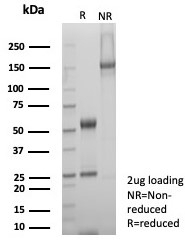 SDS-PAGE analysis of purified, BSA-free SDHA antibody (clone SDHA/7495) as confirmation of integrity and purity.