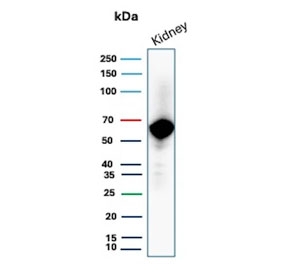 Western blot analysis of OCLN antibody in human kidney tissue lysate. The recombinant mouse mAb clone rOCLN/8776 detects a prominent band at approximately 59 kDa, consistent with the predicted molecular weight of Occludin. The observed band pattern aligns with expected endogenous OCLN expression in renal epithelial tissue and supports specific detection of the tight junction-associated protein in human kidney lysate.