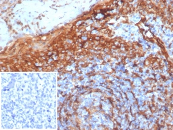 STING1 Antibody Clone STING1/7441 immunohistochemistry analysis of human tissue. IHC staining of formalin-fixed, paraffin-embedded human tonsil using STING1 Antibody Clone STING1/7441 demonstrates HRP-DAB brown cytoplasmic staining in numerous lymphoid immune cells within tonsillar tissue, consistent with expression of Stimulator of interferon genes protein / STING1 (TMEM173) in antigen-presenting cell populations. Heat-induced epitope retrieval was performed by boiling tissue sections in pH 9 10 mM Tris with 1 mM EDTA for 20 min followed by cooling prior to antibody incubation. The inset shows PBS used in place of the primary antibody as a negative control.