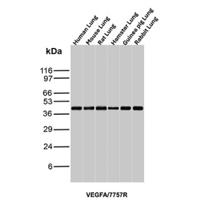 Vascular Endothelial Growth Factor Antibody Multi-Species WB. Western blot analysis of lung tissue lysates from multiple species using Vascular Endothelial Growth Factor Antibody / VEGF (clone VEGFA/7757R). Lane 1: human lung, Lane 2: mouse lung, Lane 3: rat lung, Lane 4: hamster lung, Lane 5: guinea pig lung, Lane 6: rabbit lung tissue lysate. An HRP-conjugated secondary antibody with ECL substrate was used for detection. This recombinant rabbit monoclonal Vascular Endothelial Growth Factor Antibody detects VEGFA expression across multiple species, supporting studies of angiogenesis, endothelial signaling, vascular development, and VEGF-mediated tissue remodeling pathways.