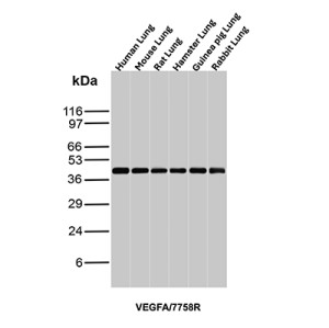 Vascular Endothelial Growth Factor Antibody Multi-Species WB. Western blot analysis of lung tissue lysates from multiple species using Vascular Endothelial Growth Factor Antibody / VEGF (clone VEGFA/7758R). Lane 1: human lung, Lane 2: mouse lung, Lane 3: rat lung, Lane 4: hamster lung, Lane 5: guinea pig lung, Lane 6: rabbit lung tissue lysate. An HRP-conjugated secondary antibody with ECL substrate was used for detection. This recombinant rabbit monoclonal Vascular Endothelial Growth Factor Antibody detects VEGFA expression across human and animal models, supporting studies of angiogenesis, endothelial cell signaling, vascular remodeling, and VEGF-mediated growth factor pathways.