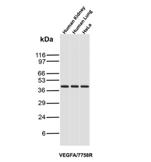 VEGFA Recombinant Rabbit Monoclonal Antibody Human Tissue WB. Western blot analysis of human kidney tissue, human lung tissue, and HeLa cell lysates using VEGFA Recombinant Rabbit Monoclonal Antibody (clone VEGFA/7758R). Lane 1: human kidney tissue lysate, Lane 2: human lung tissue lysate, Lane 3: human HeLa cell lysate. An HRP-conjugated secondary antibody with ECL substrate was used for detection. This recombinant VEGFA Antibody detects VEGFA expression in human tissue and cell samples, supporting studies of angiogenesis, endothelial cell signaling, vascular remodeling, and VEGF-mediated growth factor pathways.
