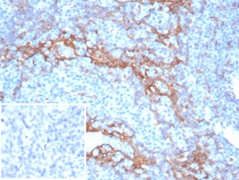 IHC staining of FFPE human tonsil tissue with STING antibody (clone STING1/7438). Inset: PBS used in place of primary Ab (secondary Ab negative control). HIER: boil tissue sections in pH 9 10mM Tris with 1mM EDTA for 20 min and allow to cool before testing.
