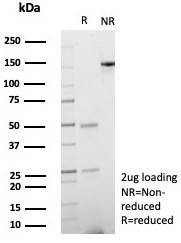 SDS-PAGE analysis of purified, BSA-free SPARC antibody (clone OSTN/8528R) as confirmation of integrity and purity.