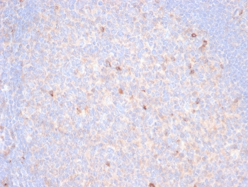IHC staining of FFPE human tonsil tissue with TIM3 antibody (clone TIM3/6863R). HIER: boil tissue sections in pH 9 10mM Tris with 1mM EDTA for 20 min and allow to cool before testing.