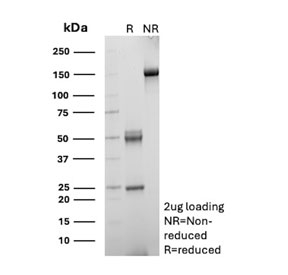 SDS-PAGE analysis of purified, BSA-free CD168 antibody (clone HMMR/8021) as confirmation of integrity and purity.