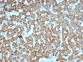 IHC staining of FFPE human liver tissue with VEGF antibody (clone VEGFA/7635R). HIER: boil tissue sections in pH 9 10mM Tris with 1mM EDTA for 20 min and allow to cool before testing.