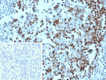 IHC staining of FFPE human tonsil tissue with recombinant MCM3/Cell Cycle Marker antibody (clone MCM3/3221). Inset: PBS instead of primary antibody, secondary only control.