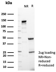 SDS-PAGE analysis of purified, BSA-free BTBD9 antibody (clone BTBD9/7501) as confirmation of integrity and purity.
