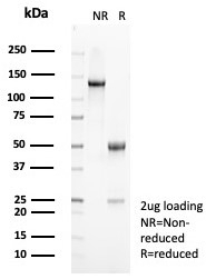 SDS-PAGE analysis of purified, BSA-free recombinant mouse HLA-DR antibody (clone rHLA-DRA/8285) as confirmation of integrity and purity.