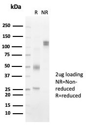 SDS-PAGE analysis of purified, BSA-free HLA-DR antibody (clone HLA-DRB/7058R) as confirmation of integrity and purity.