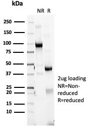 SDS-PAGE analysis of purified, BSA-free HLA-DR (HLA-DRA/6840R) as confirmation of integrity and purity.