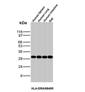 HLA-DR Antibody Rabbit Monoclonal HLA-DRA/6840R in Human Tissues and Raji Cells WB. Western blot testing of human 1) spleen, 2) lung, 3) intestine and 4) Raji B lymphoma cell lysates with HLA-DR Antibody Rabbit Monoclonal HLA-DRA/6840R. A strong, discrete band is detected at approximately 31-32 kDa in all four samples, consistent with the expected molecular weight of the HLA-DR alpha-chain component.