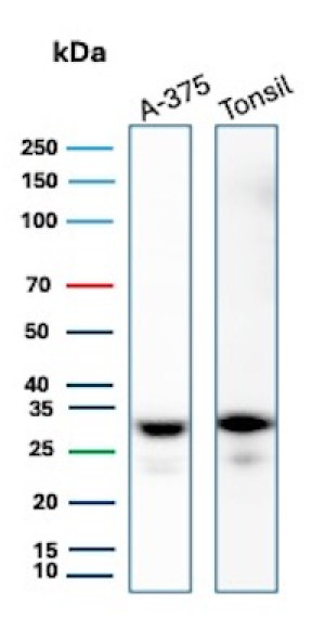 HLA-DR Antibody Rabbit Monoclonal HLA-DRA/6840R in Human A-375 Melanoma and Tonsil WB. Western blot testing of human 1) A-375 melanoma cell and 2) tonsil tissue lysates with HLA-DR Antibody Rabbit Monoclonal HLA-DRA/6840R. Strong, discrete bands are detected at approximately 30-32 kDa in both samples, consistent with the expected molecular weight of the HLA-DR alpha-chain component.