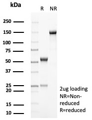 SDS-PAGE analysis of purified, BSA-free HLA-DR (HLA-DRA/8287R) as confirmation of integrity and purity.