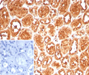 HSP70-1A Antibody HSPA1A/7932 Staining of Human Kidney IHC. Immunohistochemistry testing of FFPE human kidney tissue with HSP70-1A Antibody clone HSPA1A/7932 shows strong brown immunoreactivity in renal tubular epithelial cells, with comparatively less staining in glomerular structures. The inset secondary antibody negative control shows minimal background signal. HIER was performed by boiling tissue sections in pH 9, 10 mM Tris with 1 mM EDTA for 20 min followed by cooling before antibody testing.