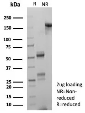 Purified HSP70-1A Antibody HSPA1A/7932 SDS-PAGE. SDS-PAGE analysis of purified, BSA-free HSP70-1A Antibody clone HSPA1A/7932 under non-reducing and reducing conditions demonstrates the expected electrophoretic profile of purified mouse IgG. Reduction produces the characteristic immunoglobulin heavy and light chain bands at approximately 50 and 25 kDa, respectively, supporting antibody integrity and purity.