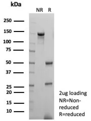 Purified HSPA1A Antibody HSPA1A/7936 SDS-PAGE. SDS-PAGE analysis of 2 ug purified, BSA-free HSPA1A Antibody clone HSPA1A/7936 under non-reducing (NR) and reducing (R) conditions. The non-reduced antibody migrates predominantly above 100 kDa, while reduction produces the expected immunoglobulin heavy and light chain bands at approximately 50 and 25 kDa, respectively, confirming antibody integrity and purity.