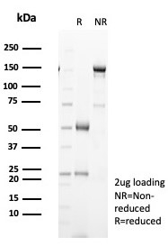 SDS-PAGE analysis of purified, BSA-free Heat shock 70 kDa protein 1B antibody (clone HSPA1B/7621) as confirmation of integrity and purity.