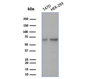 Western blot testing of human T-47D & HEK293 cell lysates using Heat shock 70 kDa protein 1B antibody (clone HSPA1B/7627). Expected molecular weight ~70 kDa.