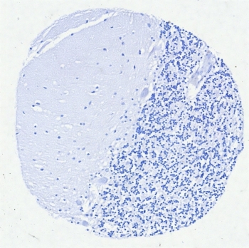 Negative control: IHC testing of FFPE human brain tissue with Interferon regulatory factor 4 antibody (clone MUM1/8560R) at 2ug/ml. HIER: boil tissue sections in pH 9 10mM Tris with 1mM EDTA for 20 min and allow to cool before testing.