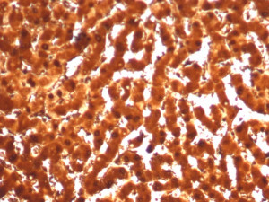 ARG1 Antibody ARG1/7514R by IHC in Human Liver. Immunohistochemistry of FFPE human liver tissue using ARG1 Antibody ARG1/7514R. Strong brown DAB staining is observed throughout the hepatocyte cytoplasm, with relatively uniform expression across the hepatic parenchyma. The staining pattern is consistent with the abundant expression of arginase 1 in hepatocytes, where it catalyzes the final reaction of the urea cycle. Heat-induced epitope retrieval was performed by boiling tissue sections in 10 mM Tris with 1 mM EDTA, pH 9, for 20 minutes, followed by cooling before antibody incubation.