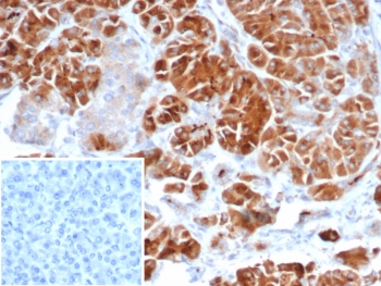 IL22RA2 Antibody Adrenal Gland IHC. Immunohistochemistry analysis of FFPE human adrenal gland tissue using IL22RA2 antibody. The mouse monoclonal antibody clone IL22RA2/7291 shows cytoplasmic staining in glandular cells, consistent with Interleukin-22 receptor subunit alpha 2 / IL22RA2 expression as an immune regulation marker. Cellular staining highlights localized production of this secreted decoy receptor within endocrine tissue, while surrounding stromal elements display lower signal. A PBS-only control confirms minimal non-specific staining. HIER: boil tissue sections in 10 mM Tris with 1 mM EDTA, pH 9, for 20 min followed by cooling prior to staining.